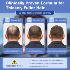 Pdam Minoxidil scalp density close-up suggests fuller look