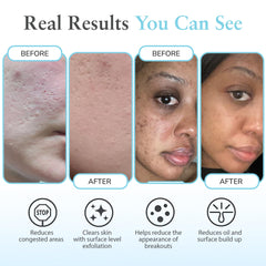 Perfect Image Salicylic 10% Gel Peel pump highlights easy, precise application.