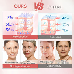 Peunitory eye balm wrinkle reduction focus on under-eye area.