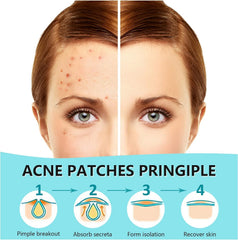 PICcircuit Pimple Patches invisible matte design blends with makeup.