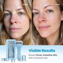 Plantifique ice roller on the face highlighting puffiness relief