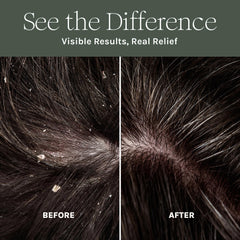 Purist Dandruff Spray scalp closeup highlights soothing, non-greasy hydration.