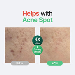 PURITO Centella Unscented Serum dropper dispensing clear gel for fast calming effects.