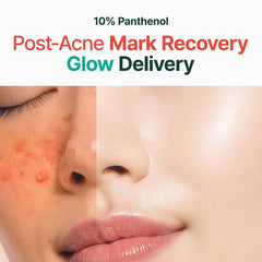 PURITO Panthenol 10% Post-Acne Cream texture close-up for soothing hydration and glow.
