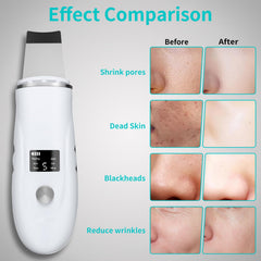 QYCSL Face Scrubber features a 3D curved design for smooth maneuvering