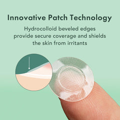 Rael Pimple Patches early-stage care visually targets redness and early blemishes.