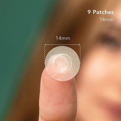 Rael pimple patches on face close-up demonstrate invisible, skin-toned coverage.