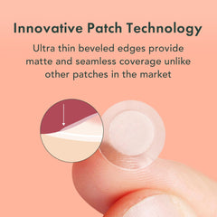 Rael Pimple Patches showing two sizes ready for different blemish sizes.