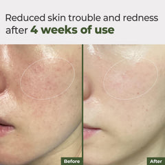 Rbfy Daily Ampoule Pad being applied to the face during a morning routine.