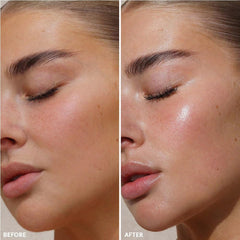 R.E.F.Y Niacinamide serum close-up; suggests brighter, more even-toned skin.