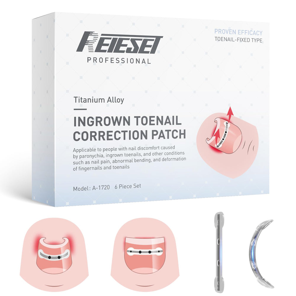 Reieset titanium alloy ingrown toenail kit cover demonstrates durable design for long-term correction.