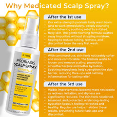 Rida Hair Psoriasis Scalp Spray helps manage dryness with a cooling, comforting sensation.