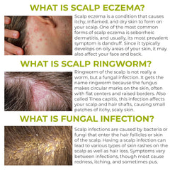 Rida Hair Folliculitis Shampoo closeup of herbal ingredients highlighting natural care