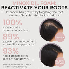 Rida Hair minoxidil foam on scalp is unscented and gentle for sensitive scalps.