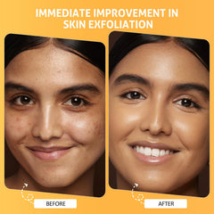 RIHAKO pumpkin enzyme mask on face shows gentle exfoliation ready for renewal.