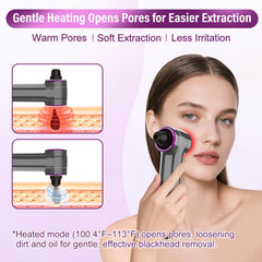 Rinycwa blackhead vacuum forehead-chin-head targets larger areas for smoother skin.