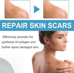 RIWYDMA Vetra Scar Stick on skin demonstrating quick fragrance-free use