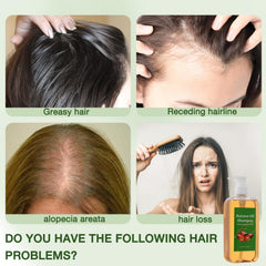 rooroopet rosemary oil dropper for revitalized scalp support.
