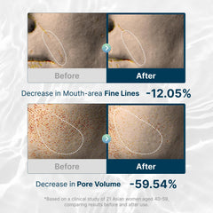 ROOTIO vegan collagen mask four-pack close-up for hydration