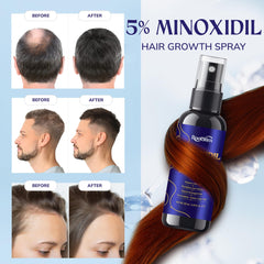 RootStim scalp closeup with thinning areas seeking fuller-looking hair