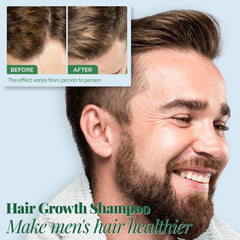 RootStim sulfate-free formula bottle emphasizes gentle cleansing safe for color-treated hair.