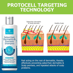 Roycederm Dandruff Shampoo bottle shows easy daily scalp cleansing