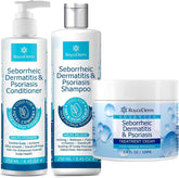 Roycederm cream tube application showing soothing relief for itchy scalp and flaking