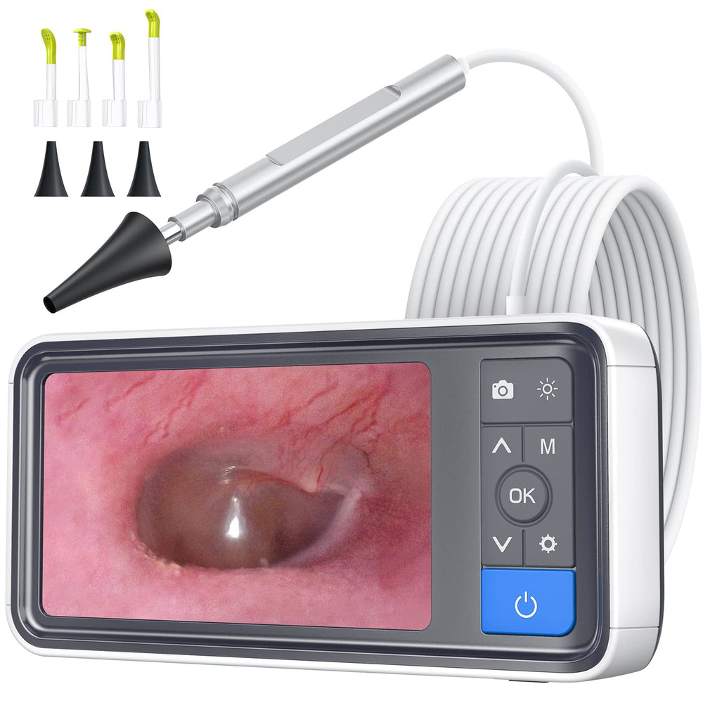 ScopeAround Otoscope ear camera with 4.5-inch screen enables clear ear checks.