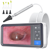 ScopeAround Otoscope ear camera with 4.5-inch screen enables clear ear checks.