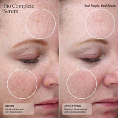 Sente Bio Complete Serum application steps show a simple night routine for smoother skin.