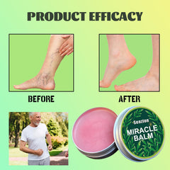 Senzion Miracle Balm hands used for joint comfort