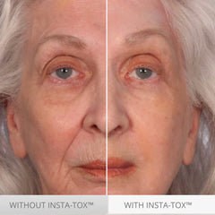 Serious Skincare INSTA-TOX on-face application hints at temporary tightening and smoothing.