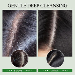 SHVYOG scalp-scrub-jojoba-oil: nourishing moisture to soothe the scalp during cleansing.