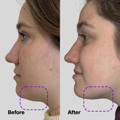 SickScience ShapeShift neck-application close-up demonstrates easy pump-on routine for daily use.