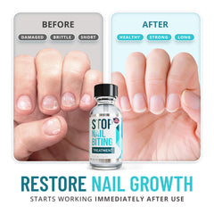 SISQUOC HEALTHCARE Stop Nail Biting application shows quick-dry in about two minutes