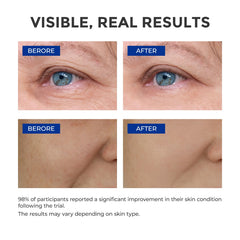 SKINERSE vitamin E and peptides bottle focus for anti-aging care.