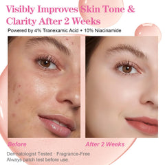 SKSOYT Arbutin Serum bottle—targeted brightening.