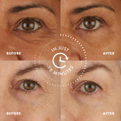 Close-up of applying Skyn ICELAND patches for spa-like 10-minute puff reduction