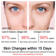 SOYUB Collagen Jelly Cream night routine image hints overnight firmness.
