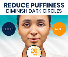 Stylia under-eye patches flat lay highlights hydrating treatment for brighter eyes.
