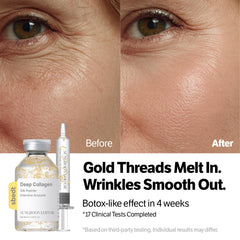 SUNGBOON EDITOR silk thread technology closeup illustrating lifting mechanism and tightening potential