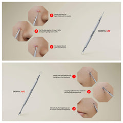 Suvorna pimple popper tool kit assembled with stainless steel implements