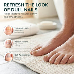 Swissklip KlearNail roll-on bottle for precise, mess-free application.
