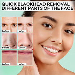 SYABO mask close-up on pores illustrating cleansing effect.