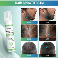 Tecflox Minoxidil Foam unscented pump emphasizes gentle, irritation-free application