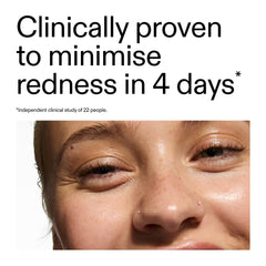 The INKEY List azelaic acid serum on skin application demonstrates quick absorption