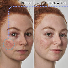 The INKEY List azelaic acid serum texture closeup highlights a light non greasy feel
