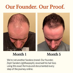 The Mane Solution Mane Elixir bottle back label—11 benefits in one bottle.