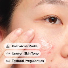The Ordinary serum applied on skin demonstrating lightweight hydration