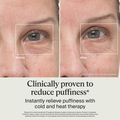 TheraFace under-eye application with contoured tip for hard-to-reach spots.